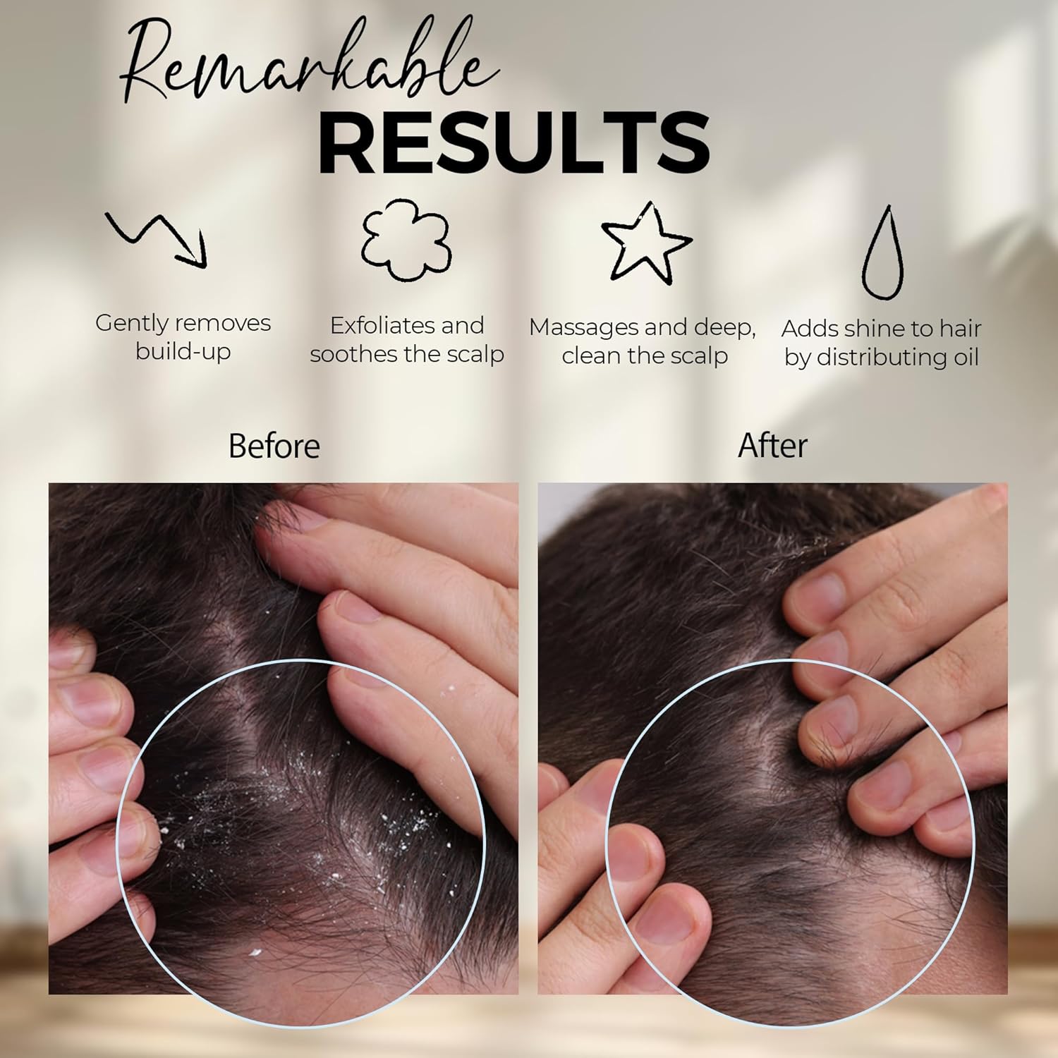 Boost Hair Care with This silicone Scalp Massage Brush